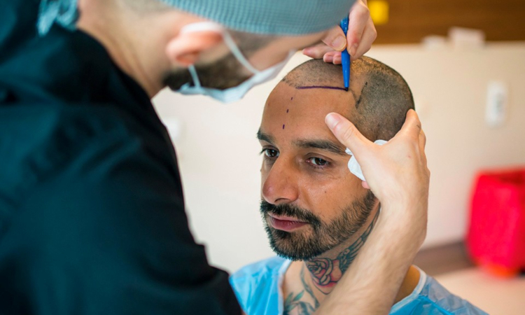 TrawellMed: Haartransplantation in der TÃ¼rkei weit Ã¼ber den Standards auf der Welr